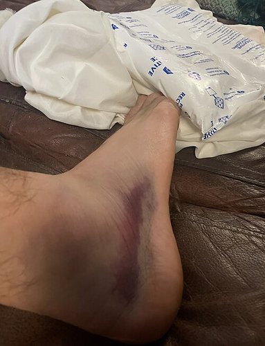 Hình minh họa từ ankle - mắt cá chân / cổ chân