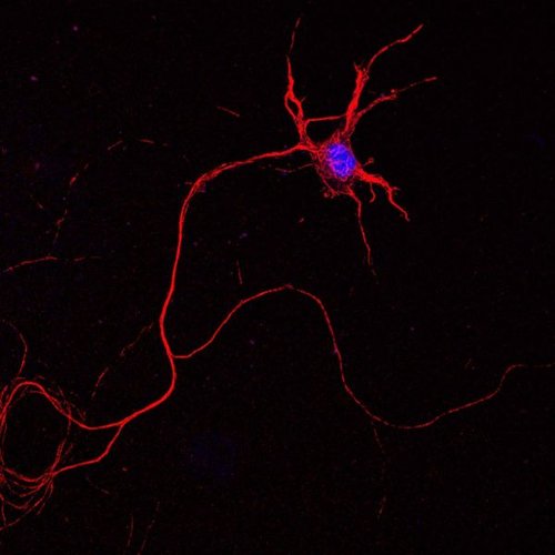Hình minh họa từ spinal cord - tủy sống