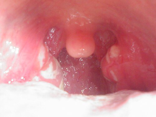 Hình minh họa từ throat - cổ họng