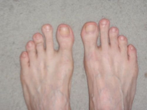 Hình minh họa từ toenail - móng chân