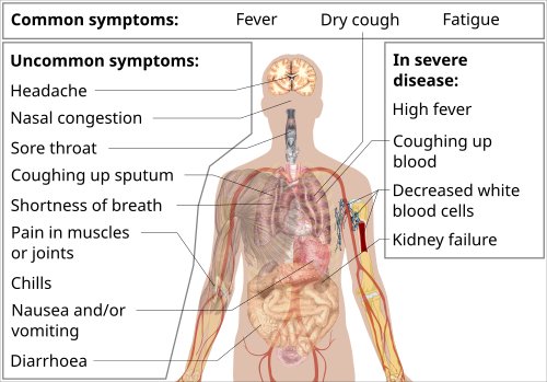 Hình minh họa từ Symptom - Triệu chứng